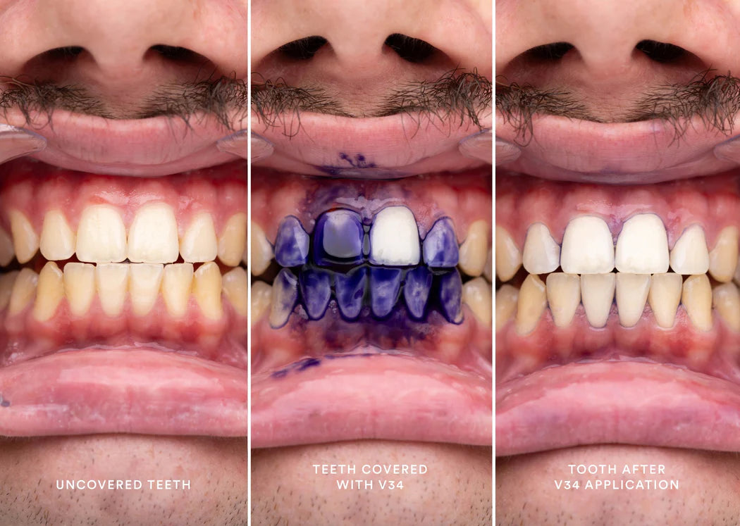 Hismile V34 Colour Corrector Serum, Teeth Whitening