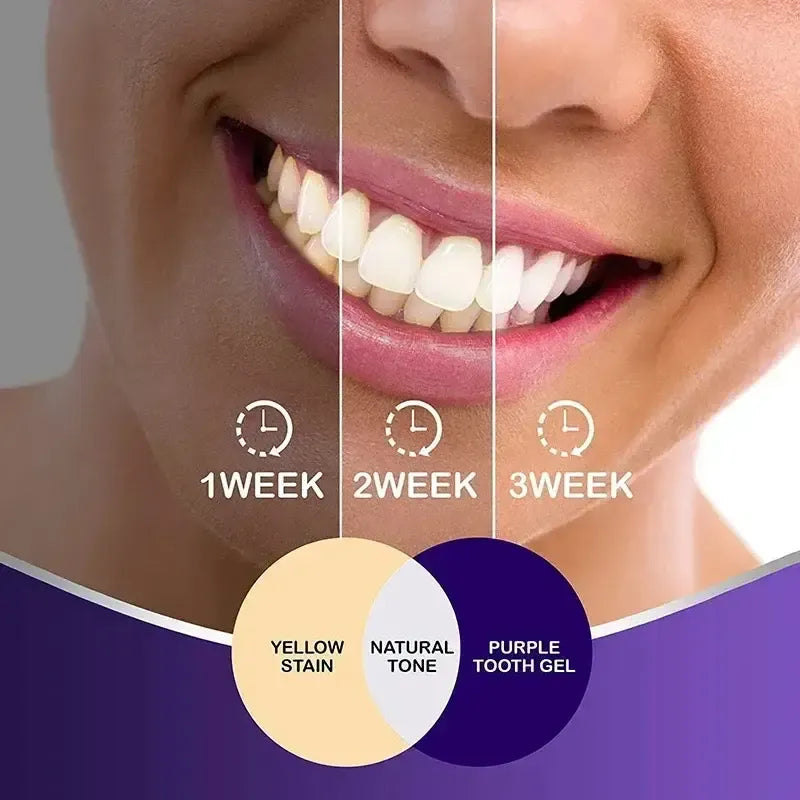 Hismile V34 Colour Corrector Serum, Teeth Whitening