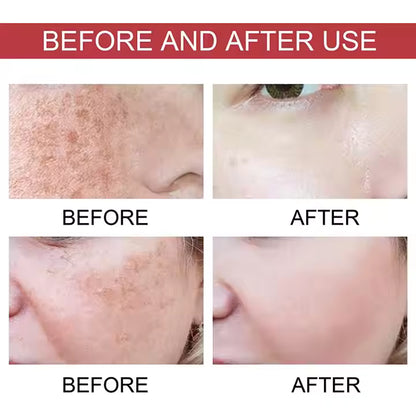 Anua Niacinamide 10% + TXA 4% Dark Spot Correcting Serum