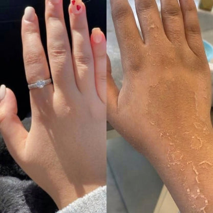 Hand & Foot Peeling Mask for Dead Skin Care